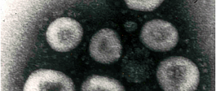 SARS-CoV-2 и COVID-19. Общие сведения